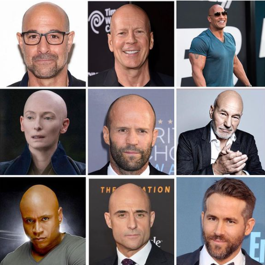 William bất ngờ được vinh danh 'Người đàn ông hói gợi cảm nhất thế giới' Ảnh 5