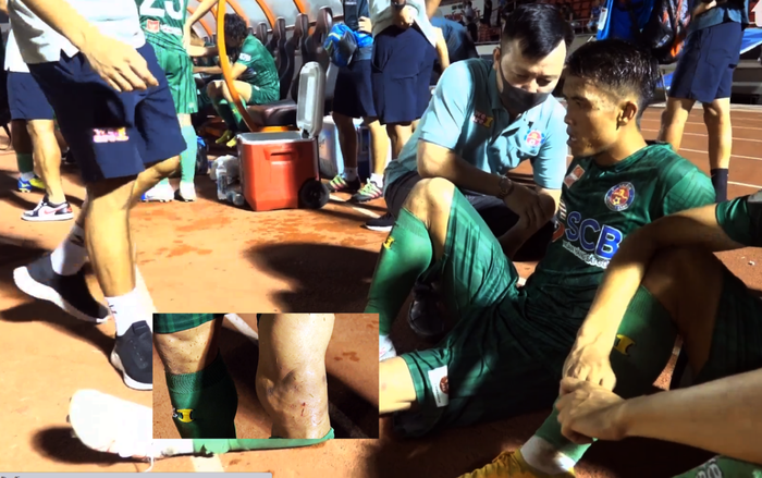 Án phạt vụ Hùng Dũng gãy chân chưa ráo mực, cựu hậu ĐTVN đã bị đối thủ đạp thô bạo! Ảnh 2