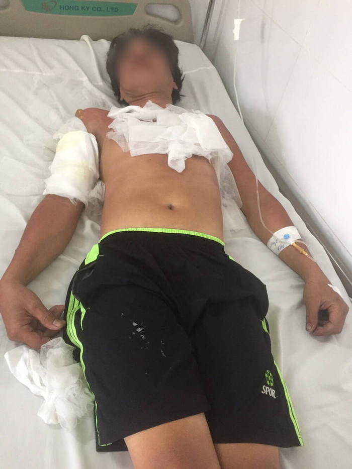 Nạn nhân duy nhất sống sót trong vụ cháy lớn 