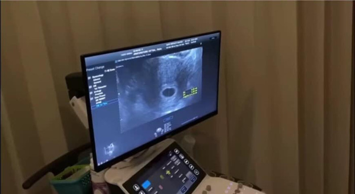 Nữ diễn viên Mew Nittha mang thai con đầu lòng sau hơn 1 năm kết hôn Ảnh 9