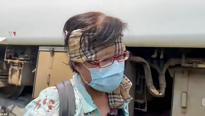 Người phụ nữ này dùng khăn cuốn tạm trên trán dính máu.