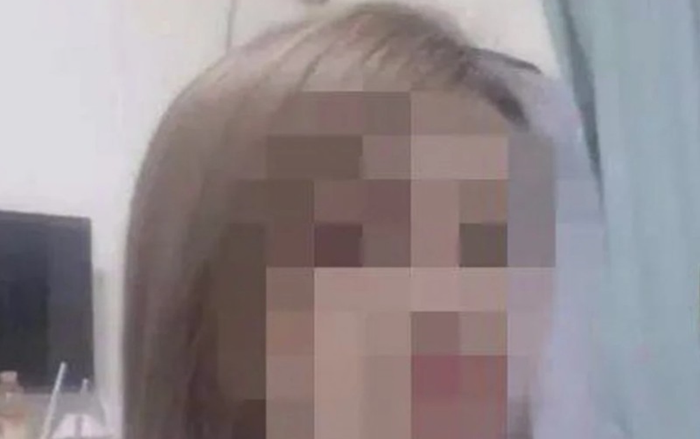 Người phụ nữ tử vong sau phẫu thuật thẩm mỹ do chết não Ảnh 2