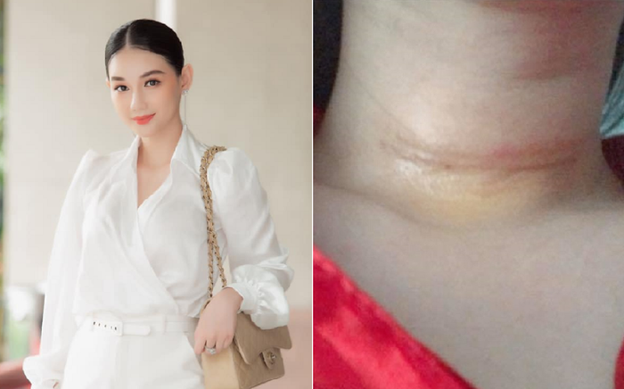 MC Quỳnh Chi phẫu thuật vì tế bào ung thư tuyến giáp xâm lấn, nhiều sao Việt gửi lời động viên Ảnh 2