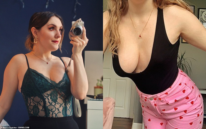 Bệnh hiếm khiến cô gái có bộ ngực siêu lệch, nhưng quyết không động tới dao kéo Ảnh 2