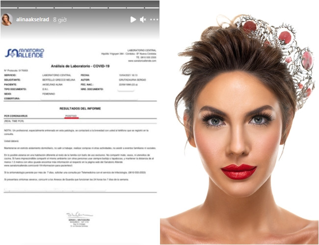 Đại diện Argentina chính thức có kết quả dương tính với Covid-19.