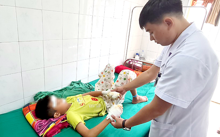 Bé 13 tuổi bị rách giác mạc, dập nát 2 bàn tay do pin phát nổ Ảnh 2