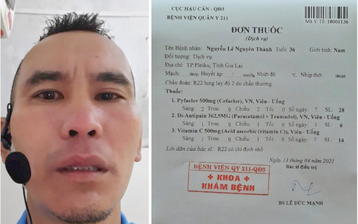 Thủ môn CLB TP.HCM 'gạt tay trúng má', trợ lý trọng tài V-League gãy răng Ảnh 2