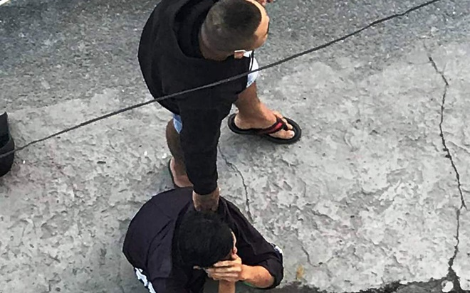 Bị cô gái 20 tuổi truy đuổi, tên cướp tông vào gốc cây ngã gãy chân Ảnh 2