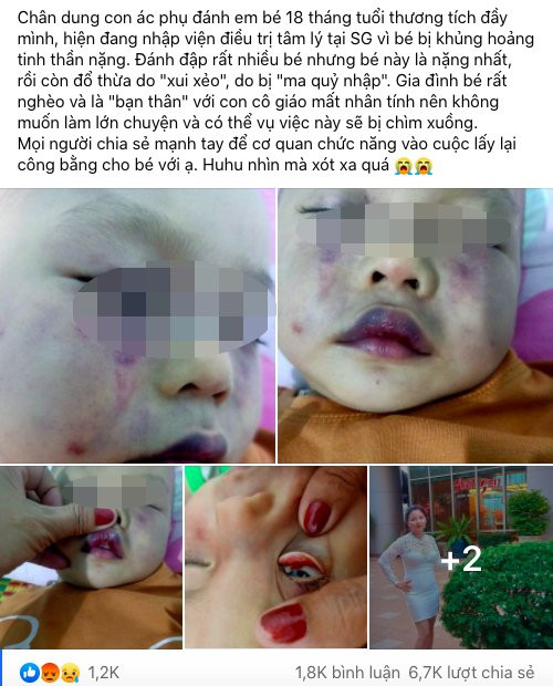 Thông tin kèm hình ảnh bé trai bị bạo hành được chia sẻ trên MXH.
