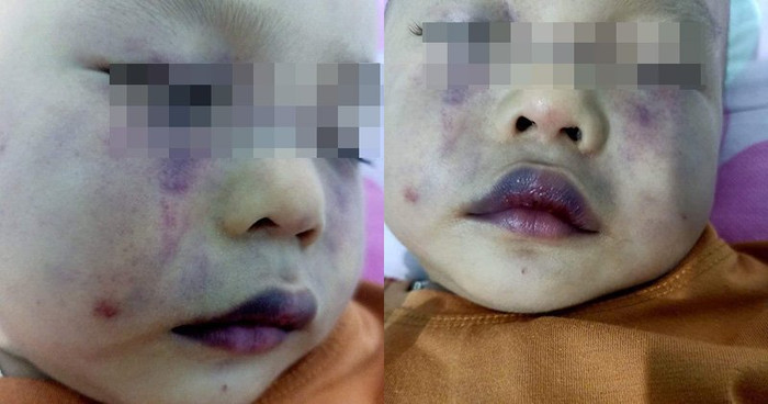 Những hình ảnh bé trai bị bạo hành khiến nhiều người không khỏi xót xa, phẫn nộ