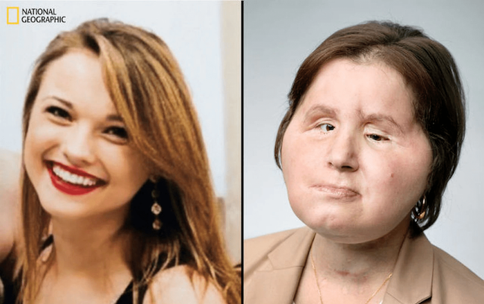 Nổ súng vào mặt tự tử nhưng không chết, cô gái xinh đẹp hỏng cả gương mặt và màn 'lột xác' sau 6 năm Ảnh 2