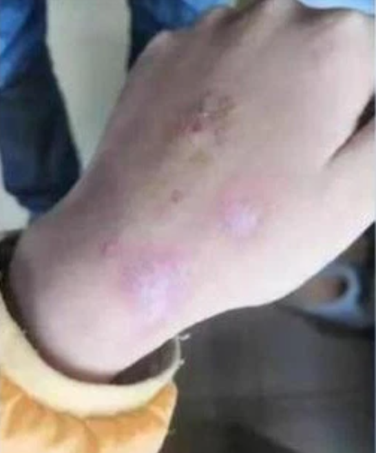 Học hành 'không đạt chuẩn của mẹ', bé gái 12 tuổi bị bạo hành dã man Ảnh 6