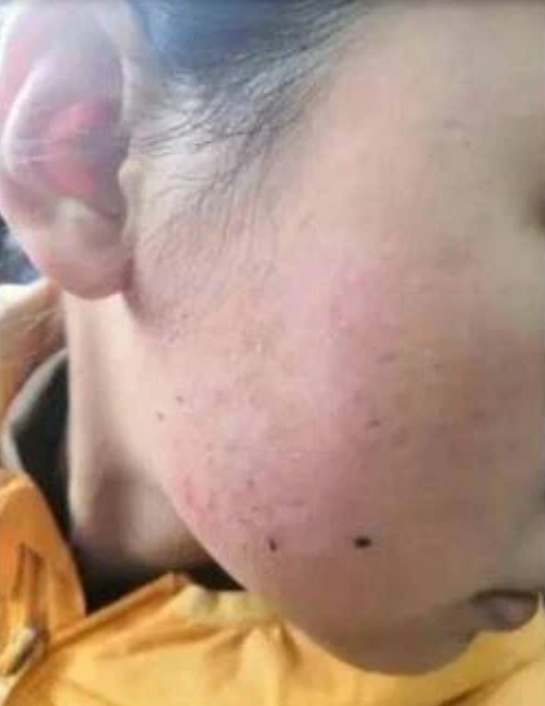 Học hành 'không đạt chuẩn của mẹ', bé gái 12 tuổi bị bạo hành dã man Ảnh 4
