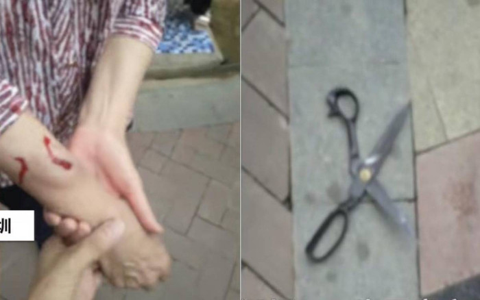 Đang đi dạo phố, người phụ nữ bất ngờ bị chiếc kéo ở tầng 28 rơi trúng người Ảnh 2