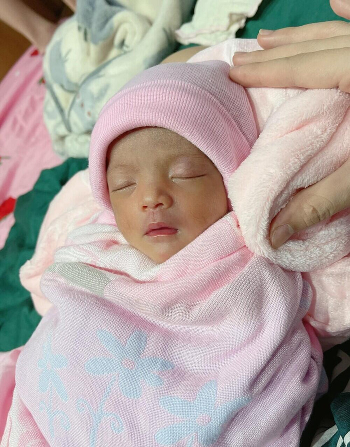 Hình ảnh bé Minnie thời điểm vừa chào đời