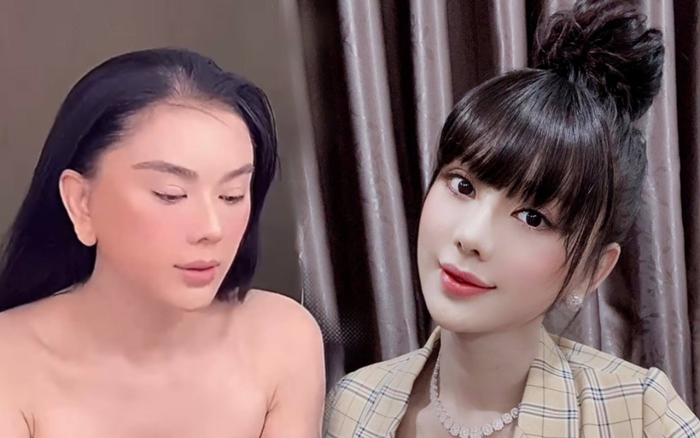 Lâm Khánh Chi lộ trán hói, tóc thưa thớt phải dùng mái giả để che chắn Ảnh 2