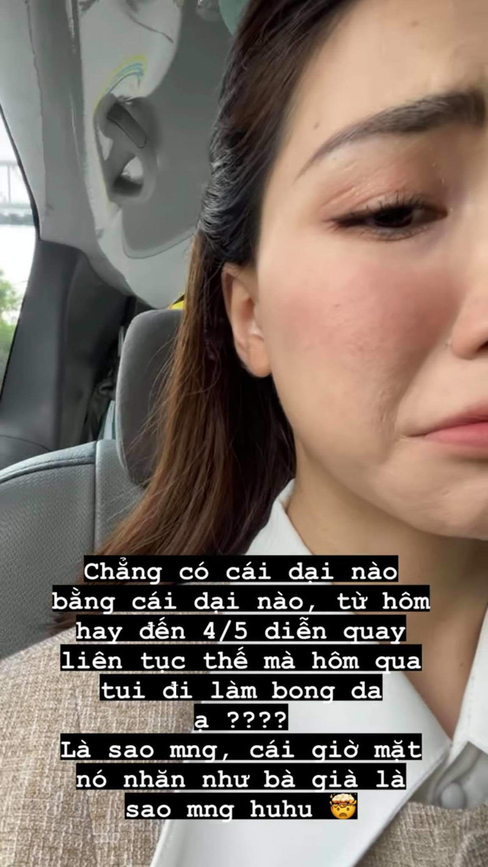 Gương mặt 'nhăn như bà già, bong từng mảng tựa da rắn'.