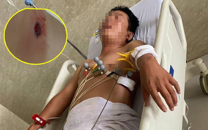 Hẹn giải quyết nợ nần ở quán cà phê, người đàn ông rút súng bắn con nợ nhiều phát Ảnh 2