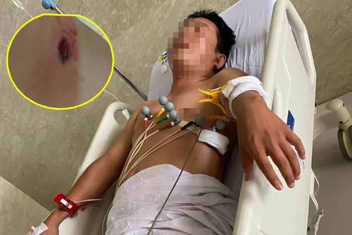 Nạn nhân đang được điều trị tại bệnh viện