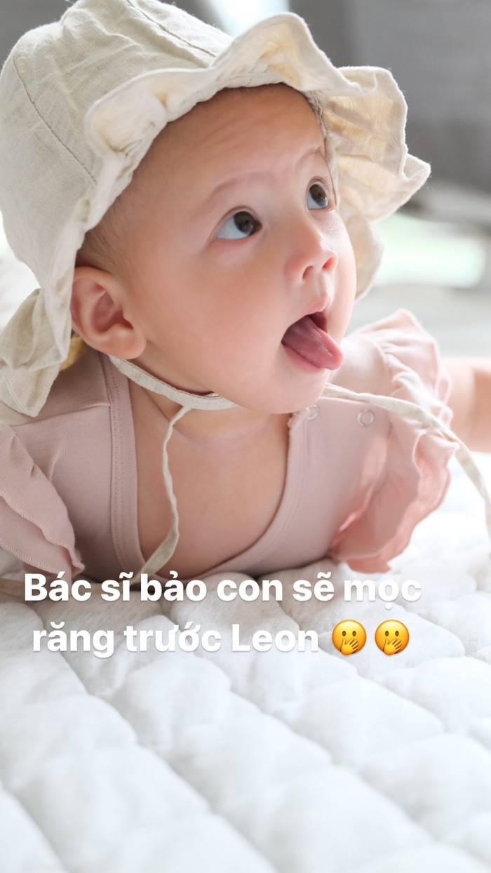 'Chị ba' Lisa được dự đoán sẽ mọc răng trước em Leon.
