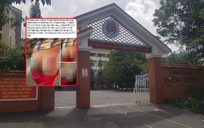 Đình chỉ công tác đối với cô giáo đánh học sinh bầm mông, xảy ra xô xát với phụ huynh Ảnh 2