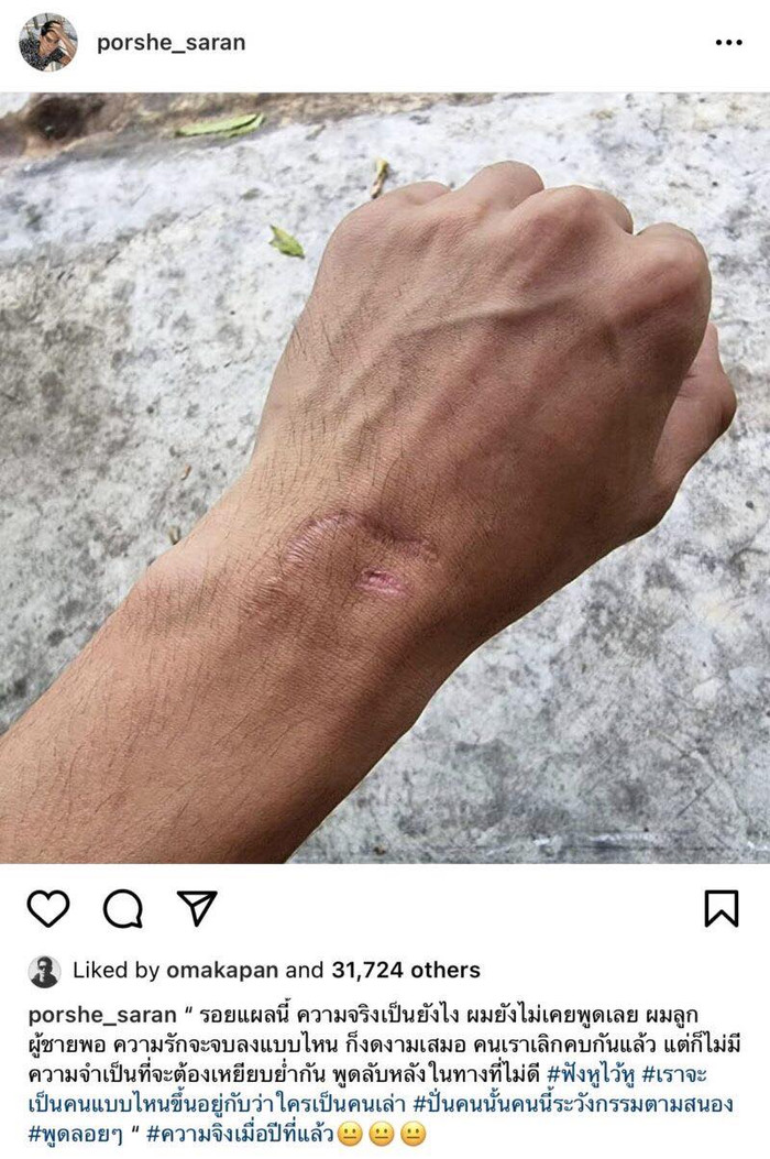 Phản dame cực gắt, Porshe Saran tung ảnh nộp đơn kiện ngược lại Dao Pimthong vì tội tổn hại thân thể Ảnh 4