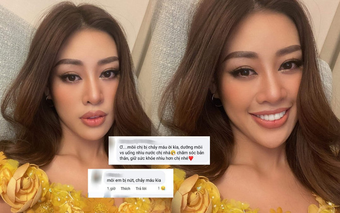 Khánh Vân tung ảnh selfie cực xinh, nào ngờ lộ đôi môi nứt nẻ toạc cả máu khiến fan xót xa Ảnh 2