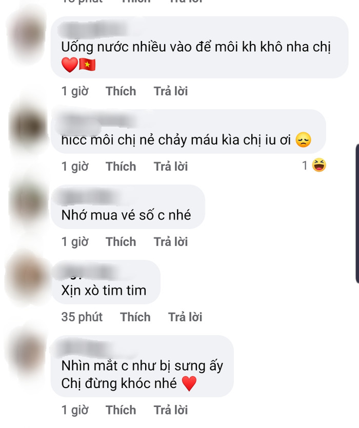 Uống nước nhiều, thoa kem dưỡng môi là những điều khán giả khuyên Khánh Vân nên làm lúc này.