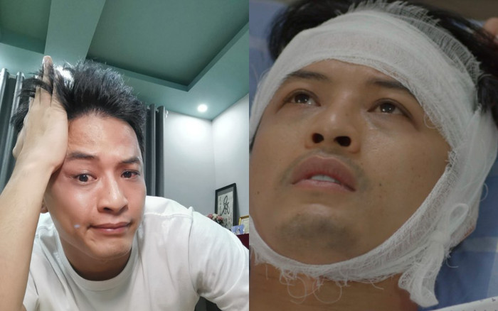 Hồng Đăng chốt vai Kiên trong 'Hướng dương ngược nắng' là vai diễn thê thảm nhất trong 17 năm làm nghề Ảnh 2