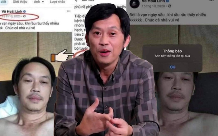 Bị tố 'khai gian' ngày mổ tuyến giáp, phía Hoài Linh lập tức xóa ảnh trên trang cá nhân? Ảnh 2