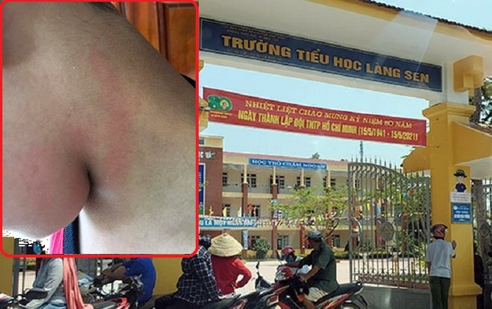 Vụ mẹ tìm đến tận nhà tát bạn học của con để 'trả đũa': Phạt hành chính 2,5 triệu đồng Ảnh 2