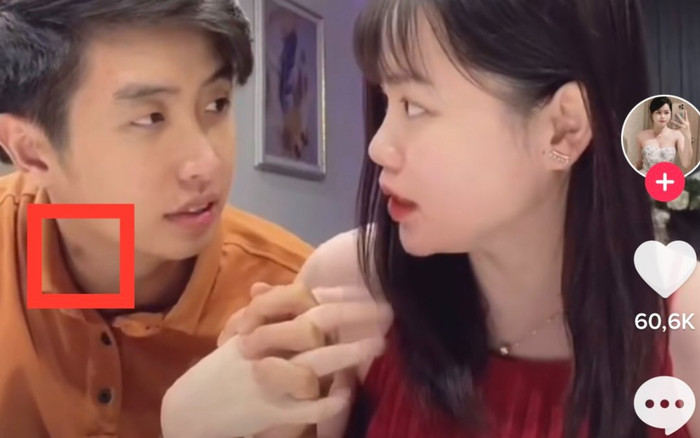 Netizen xôn xao khi soi ra dấu 'hickey' trên cổ của 'bạn trai tin đồn' Huỳnh Anh Ảnh 2