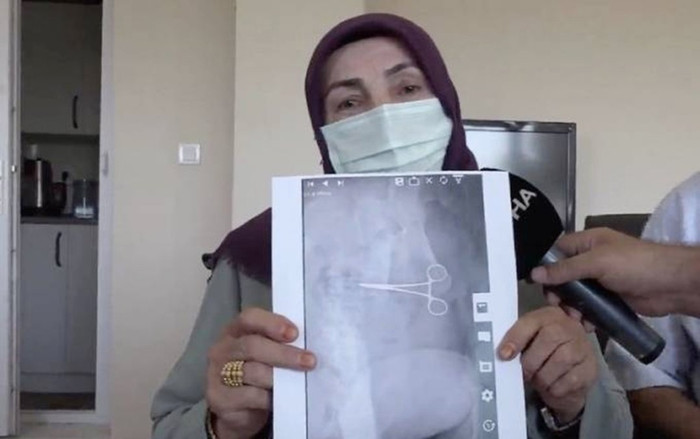 Bụng sưng và đau nhiều sau phẫu thuật, người phụ nữ tái mặt khi biết nguyên nhân Ảnh 2