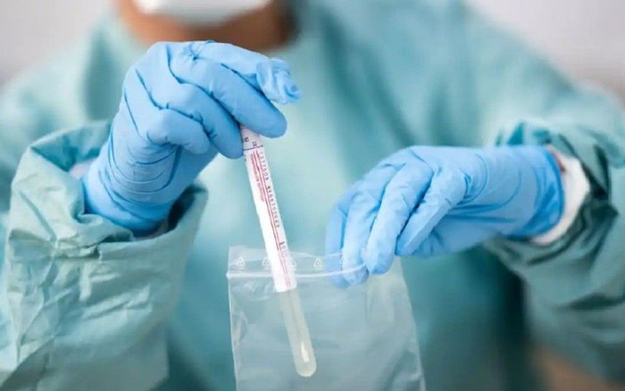 Truyền thông quốc tế đưa tin Việt Nam phát hiện biến thể Covid-19 mới lai tạo, có tốc độ lây lan nhanh Ảnh 2