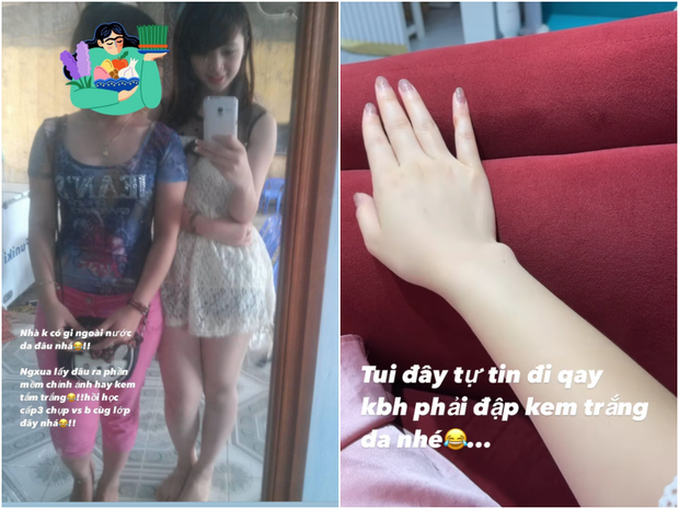 Bằng chứng Quỳnh Kool có làn da trắng tự nhiên từ nhỏ.