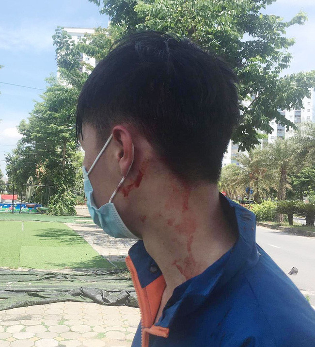 Nam shipper bị nhóm cướp đâm bị thương.