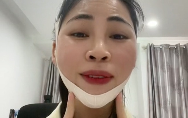 Trở lại với gương mặt khác lạ, YouTuber Thơ Nguyễn khiến dân tình đặt nghi vấn phẫu thuật thẩm mỹ Ảnh 2