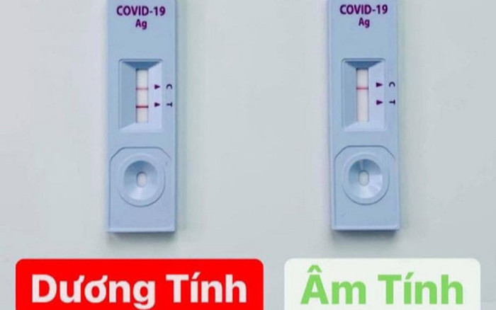 Bộ Y tế cảnh báo sử dụng test nhanh SARS-CoV-2 bán trên mạng Ảnh 2
