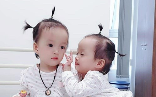 Cặp song sinh dính liền Trúc Nhi - Diệu Nhi tròn 2 tuổi: Đã có thể chạy loanh quanh nhà, nói bi bô líu lo Ảnh 2