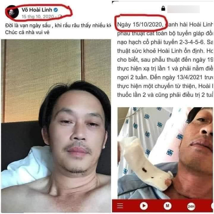 Bức ảnh đăng lên mạng xã hội của Hoài Linh vào ngày 15/10 không có vết mổ.