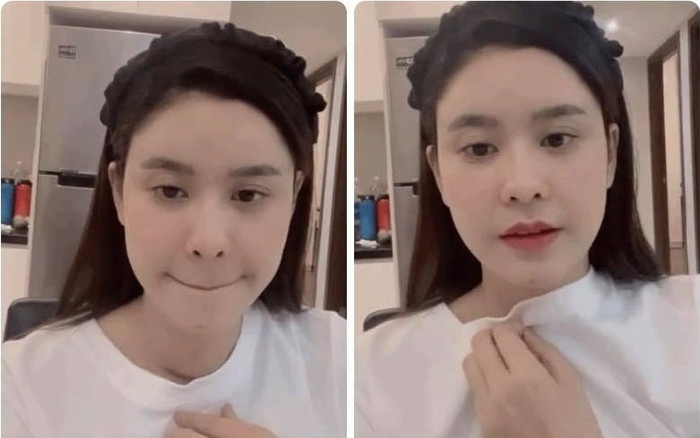 Sau Hoài Linh, Trương Quỳnh Anh tiết lộ mắc bệnh tuyến giáp, vừa phẫu thuật với vết mổ dài Ảnh 2