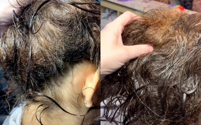 Người phụ nữ bị chấy làm tổ trên đầu đến tiệm tóc, cách xử lí của cô thợ khiến nhiều người trầm trồ Ảnh 2