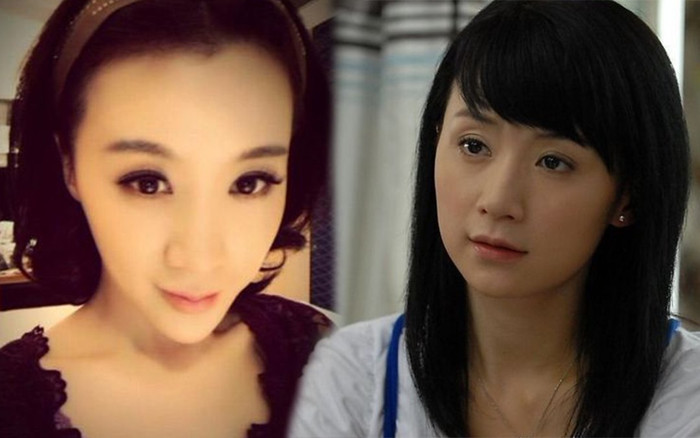 Từng được ca tụng 'nữ vương phim bi kịch', ngọc nữ Trung Quốc gây tiếc nuối khi biến thành 'mặt xà tinh' Ảnh 2