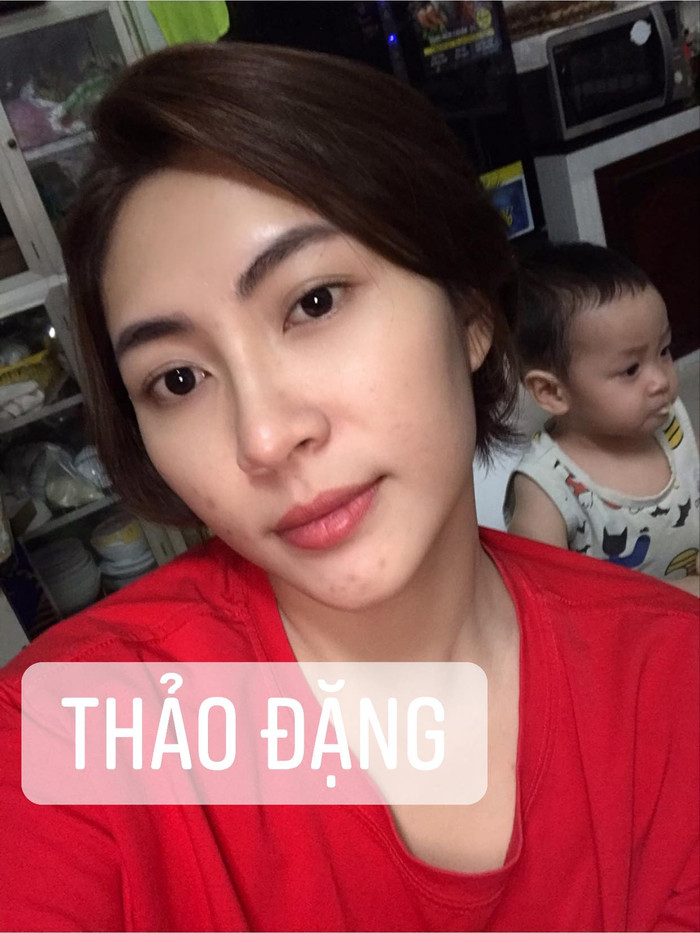 Hoa hậu Đại dương Đặng Thu Thảo khiến dân tình 'phát hoảng' với gương mặt mọc đầy mụn Ảnh 8