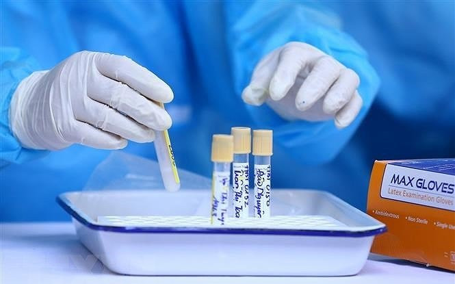 Thêm 116 ca Covid-19, TP HCM dẫn đầu Ảnh 2