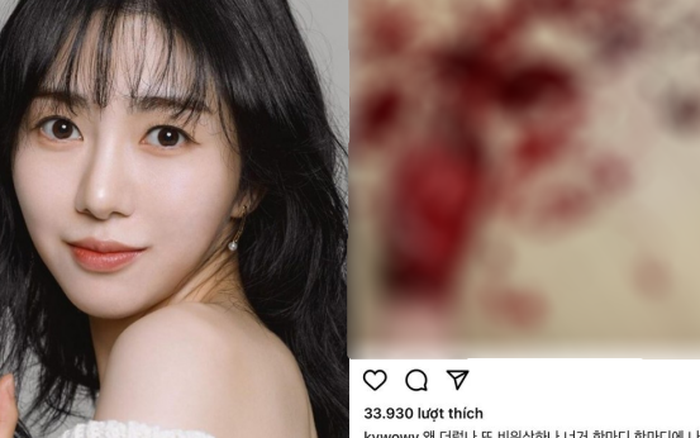 Hậu hàng loạt hành động cực đoan: Cựu thành viên AOA từng bị bắt nạt công khai bạn trai Ảnh 7