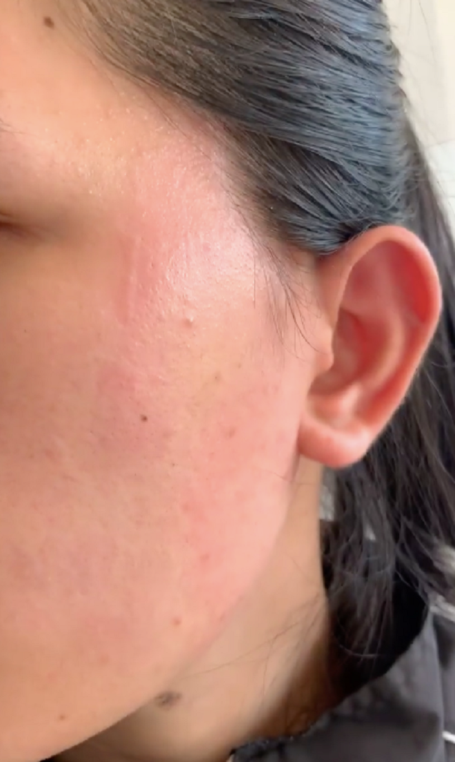 Chị Giang bị bà chủ phòng khám nha khoa tát vào mặt