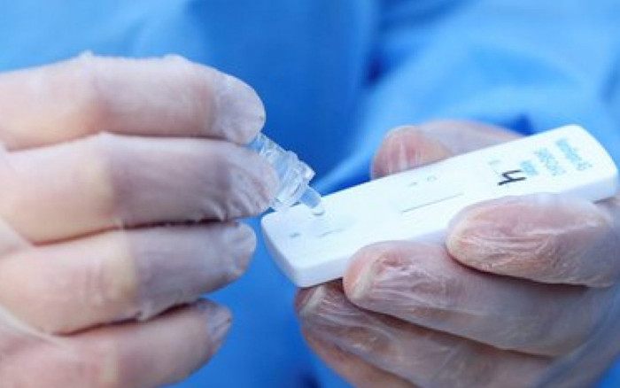 TikTok tràn lan video hướng dẫn làm giả kết quả dương tính Covid-19 Ảnh 2