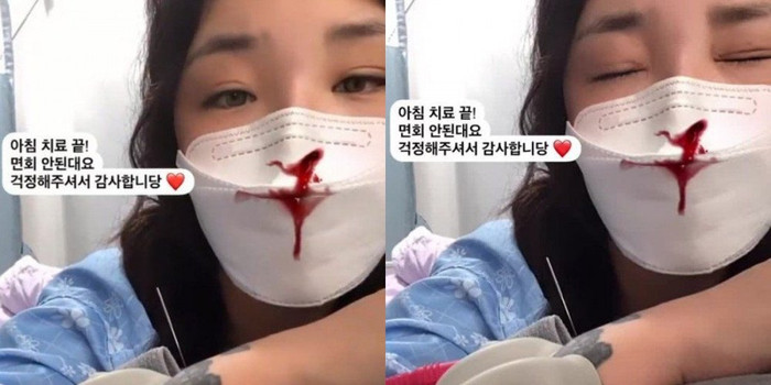 Nữ thần tượng chia sẻ những hình ảnh gần đây về quá trình hồi phục của bản thân.