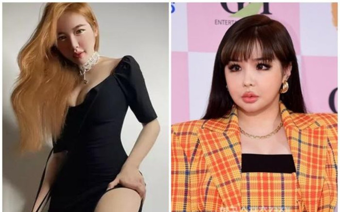 Elly Trần lộ mặt đơ cứng, nhiều người so sánh giống Park Bom phẫu thuật lỗi Ảnh 2